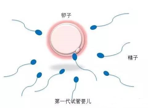 42岁二胎案例